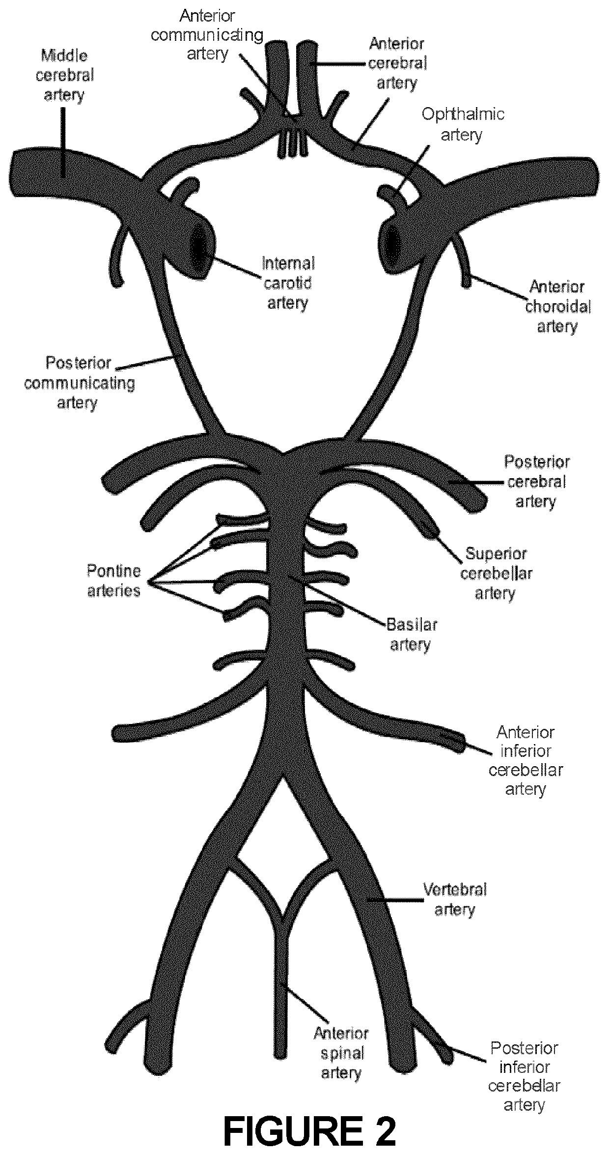 Stent and Catheter Systems for Treatment of Unstable Plaque and Cerebral Aneurysm