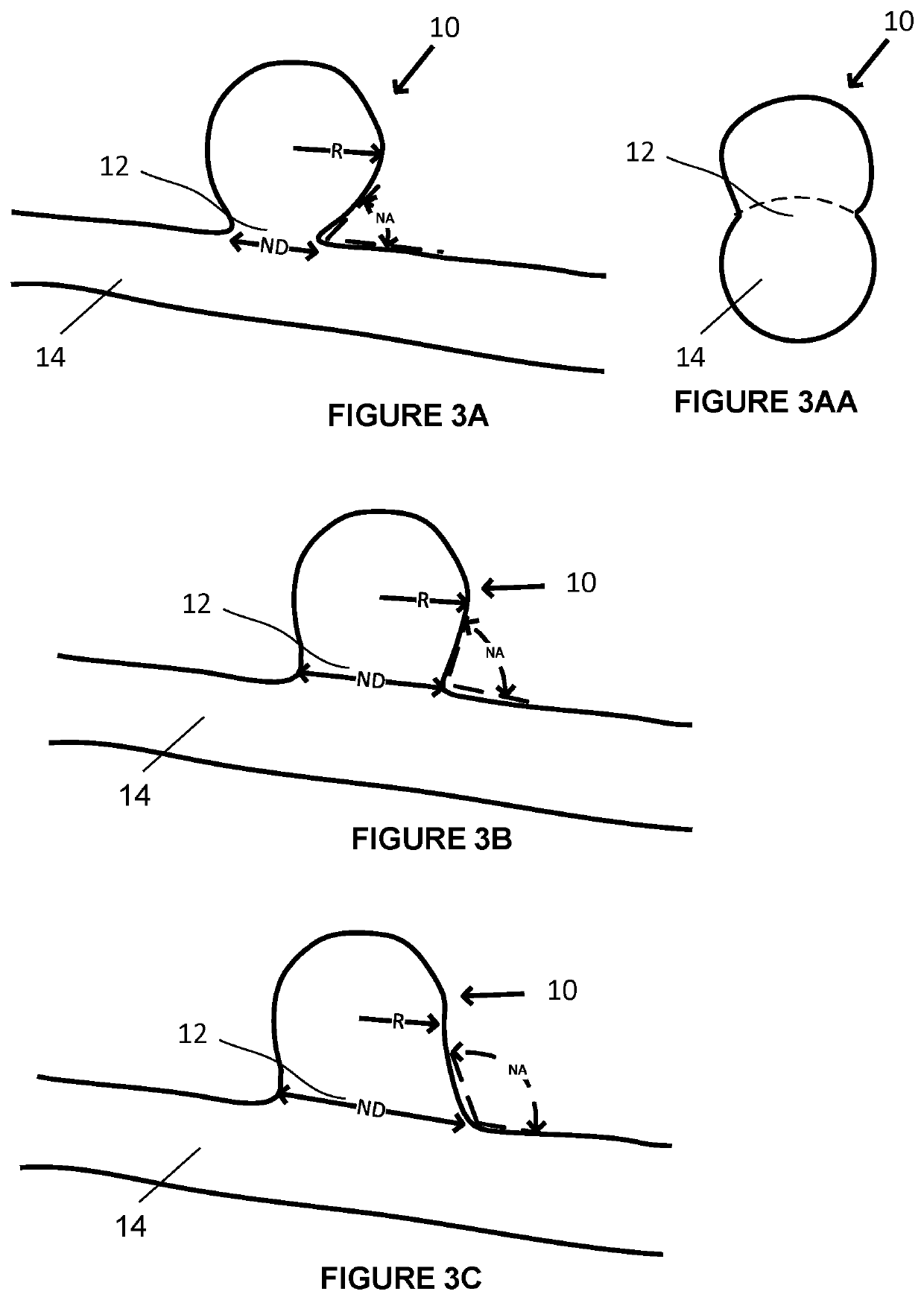 Stent and Catheter Systems for Treatment of Unstable Plaque and Cerebral Aneurysm