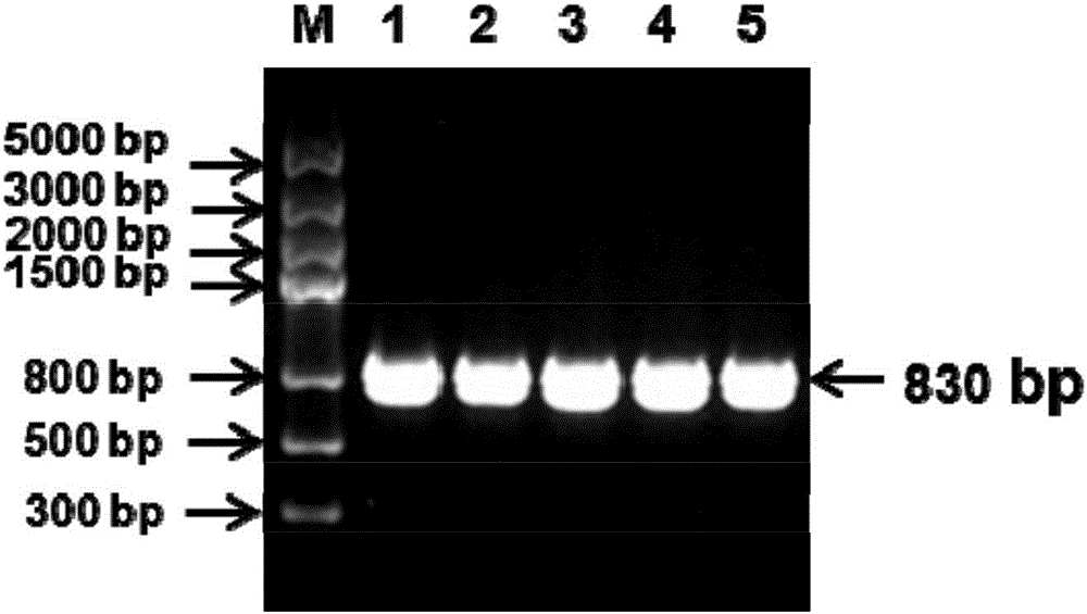 Universal kit for detecting different genotypes of infectious bronchitis viruses