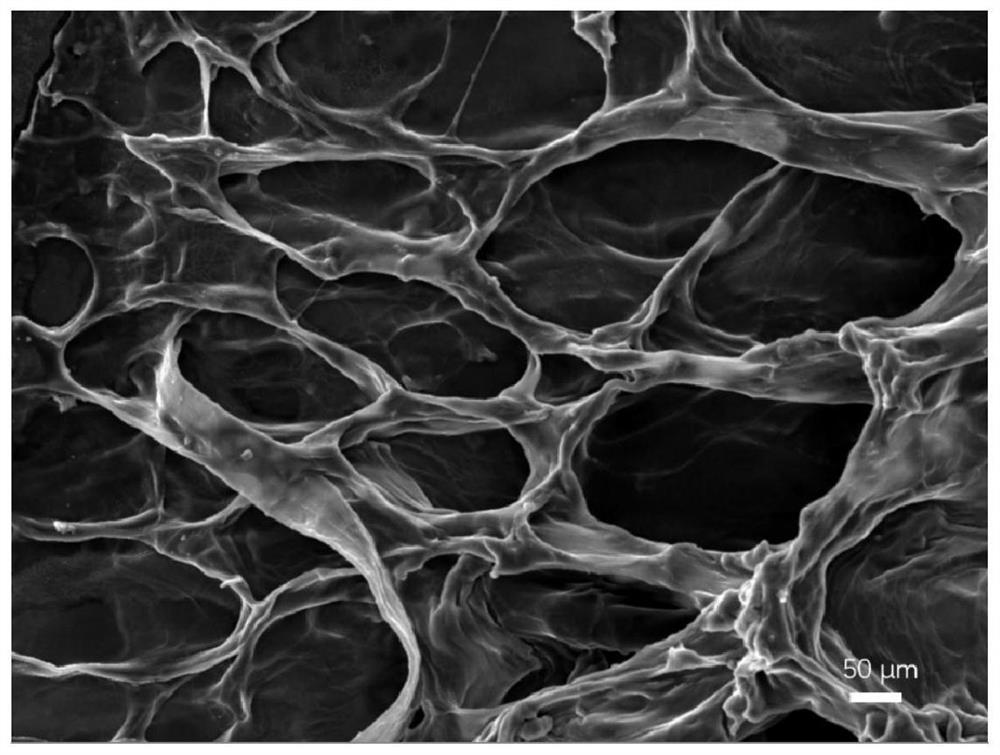 Method for inhibiting growth of zinc dendrites in zinc ion battery