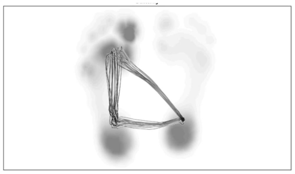 A method for evaluating gait patterns in patients with unilateral Achilles tendon rupture during rehabilitation