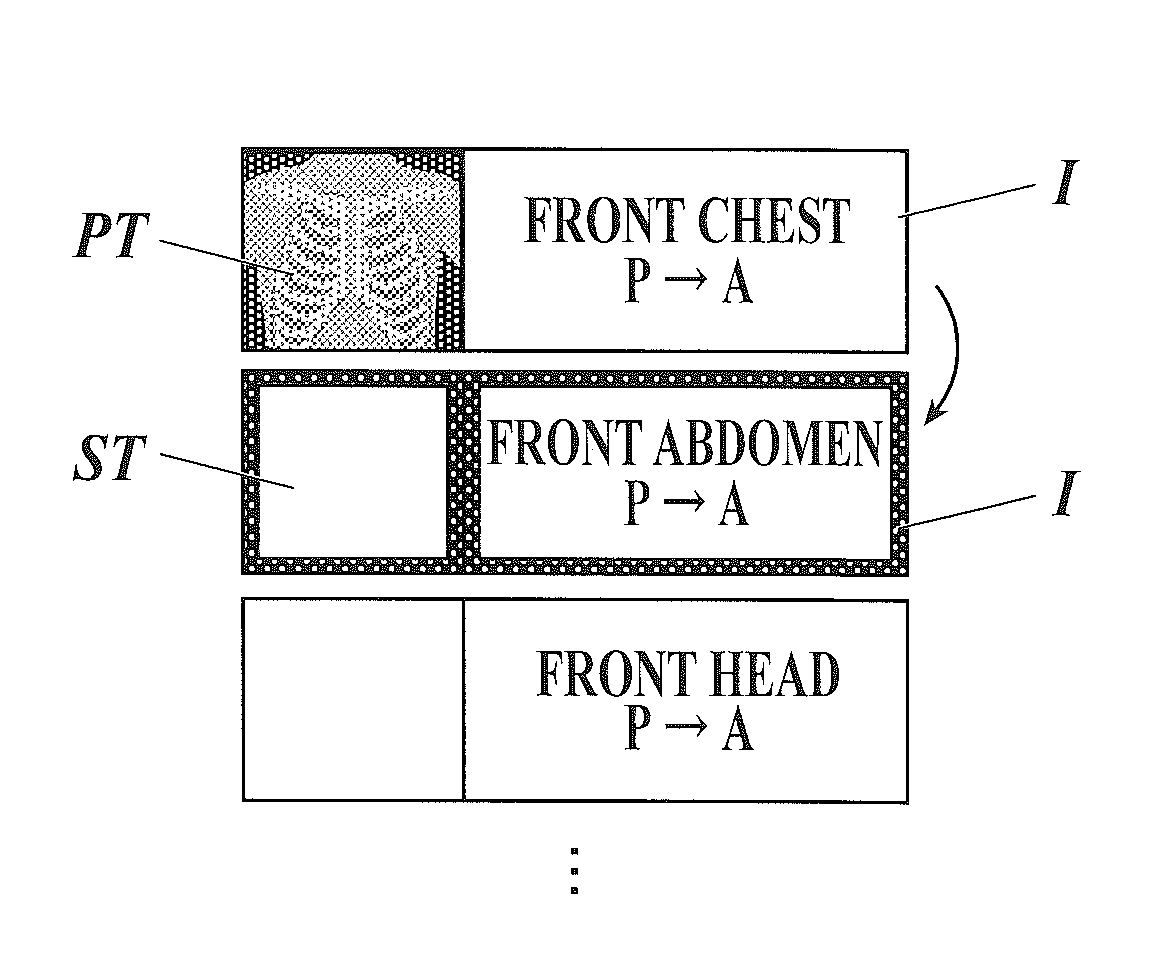 Radiographic image capturing system and console