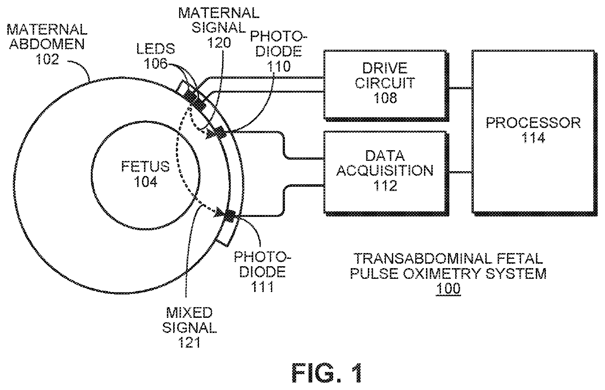 Robust, clinical-grade transabdominal fetal pulse oximetry