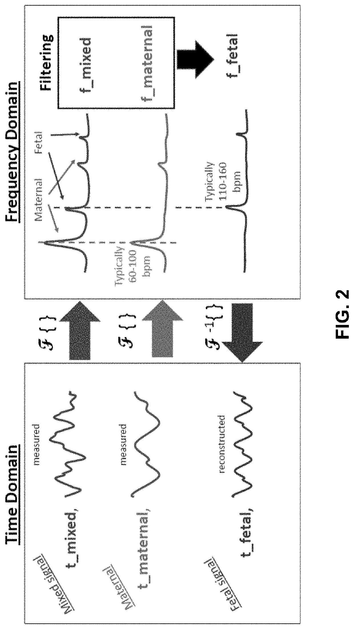 Robust, clinical-grade transabdominal fetal pulse oximetry