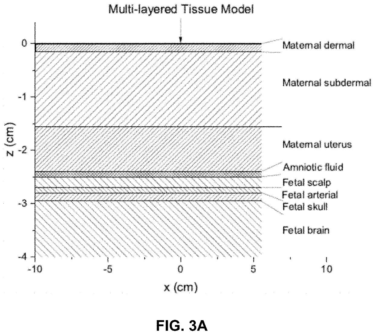 Robust, clinical-grade transabdominal fetal pulse oximetry