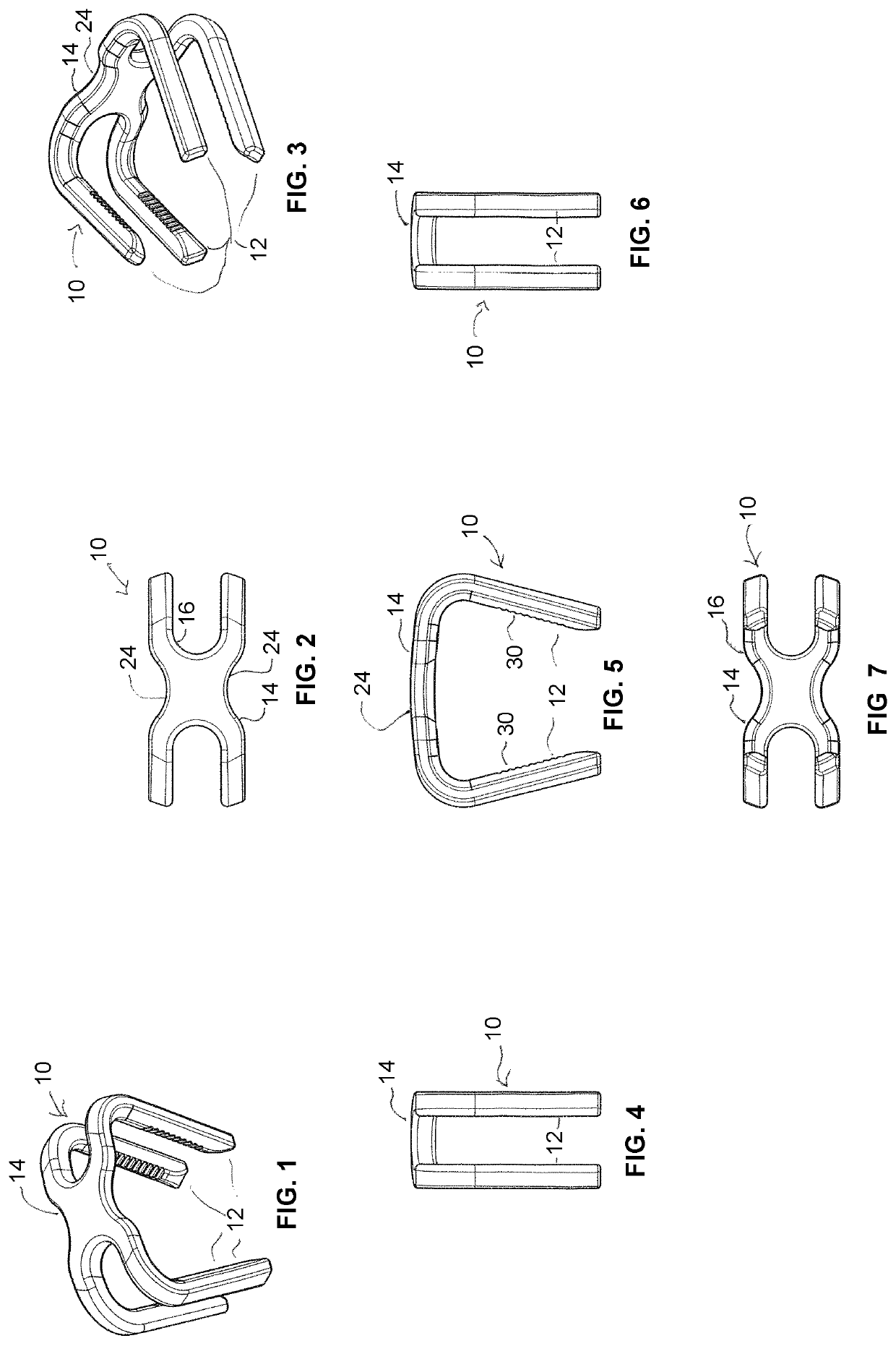 Superelastic bone compression staple