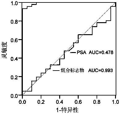 Urine sample combined markers for diagnosis of prostate cancer and detection kit and method