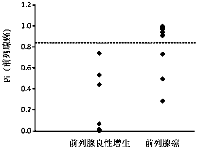 Urine sample combined markers for diagnosis of prostate cancer and detection kit and method