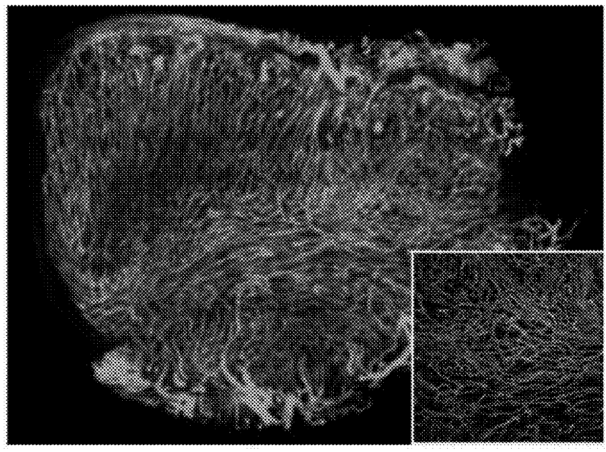 Leukocyte infiltration promoting agent and antitumor immunostimulatory agent