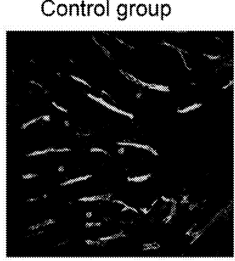 Leukocyte infiltration promoting agent and antitumor immunostimulatory agent