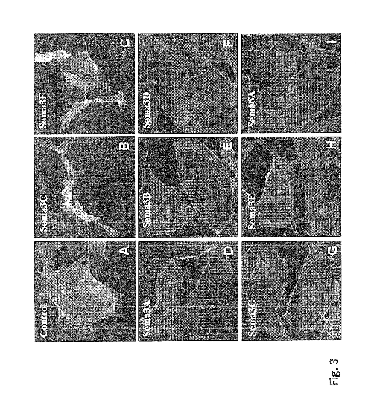 Semaphorin 3C variants, compositions comprising said variants and methods of use thereof