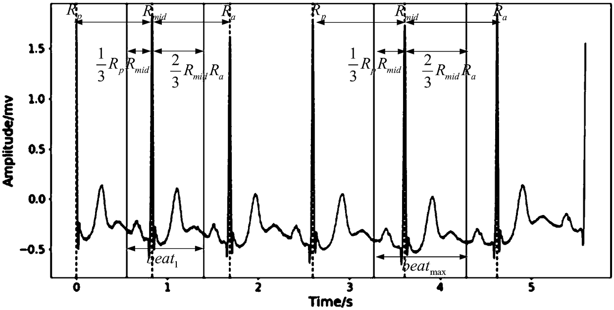 Atrial fibrillation recognition method, device and equipment, and computer-readable storage medium