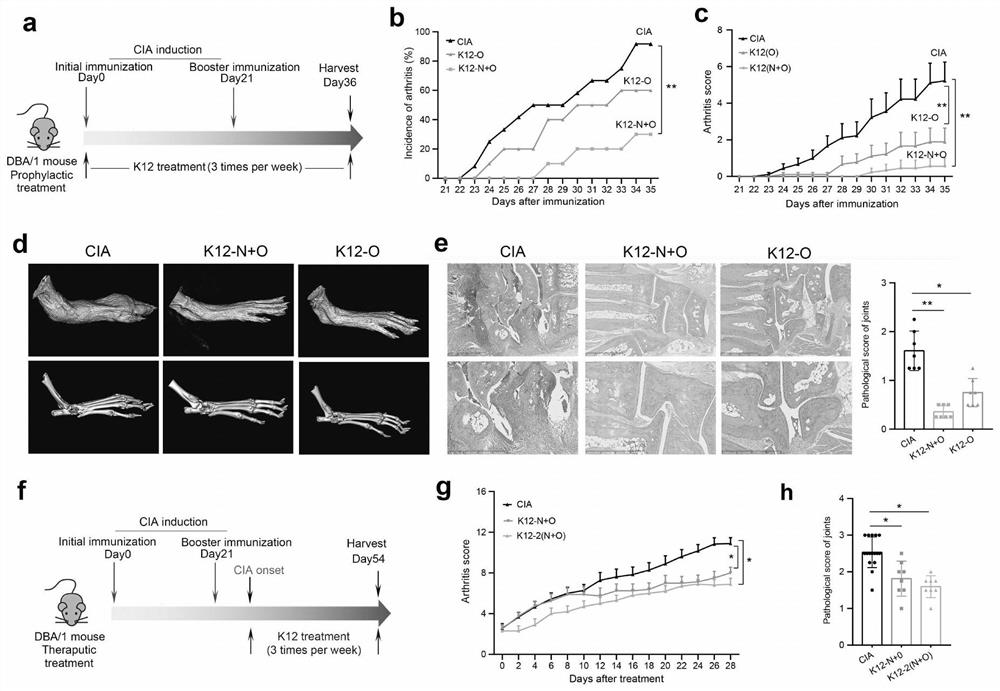 Application of Streptococcus salivarius k12 in the preparation of medicaments for preventing and/or treating autoimmune diseases