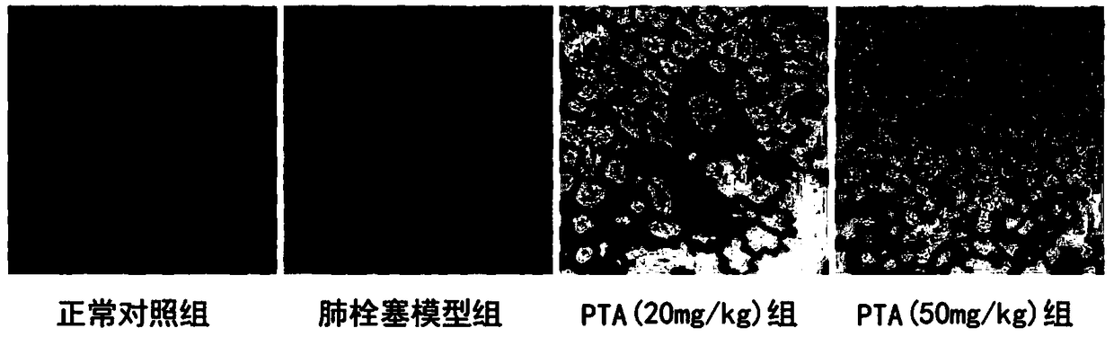 Application of compound in preparing medicine for treating acute pulmonary embolism