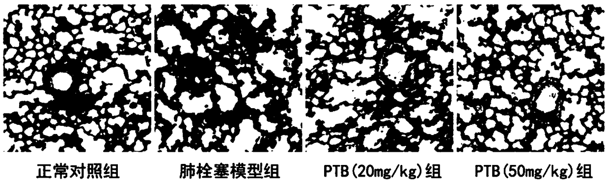 Application of compound in preparing medicine for treating acute pulmonary embolism