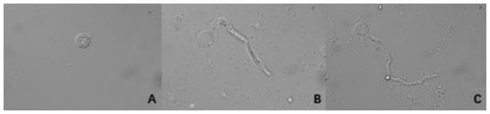 A strain of Bacillus Velez and its application in the control of plant downy mildew