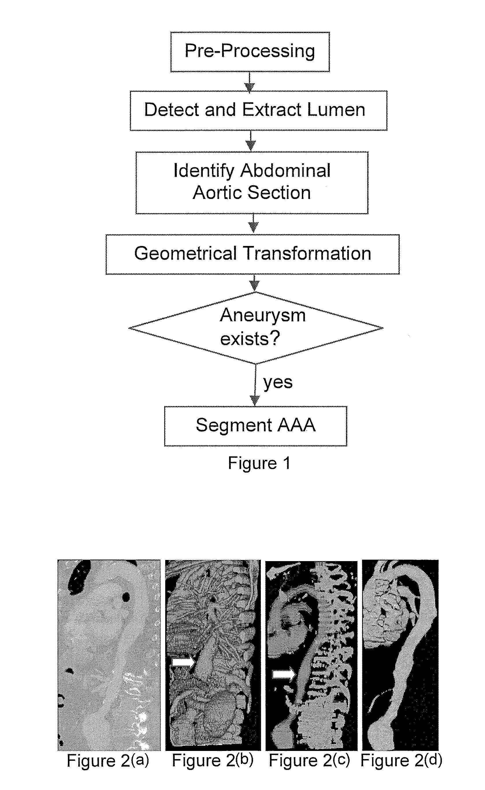 Automatic detection and accurate segmentation of abdominal aortic aneurysm