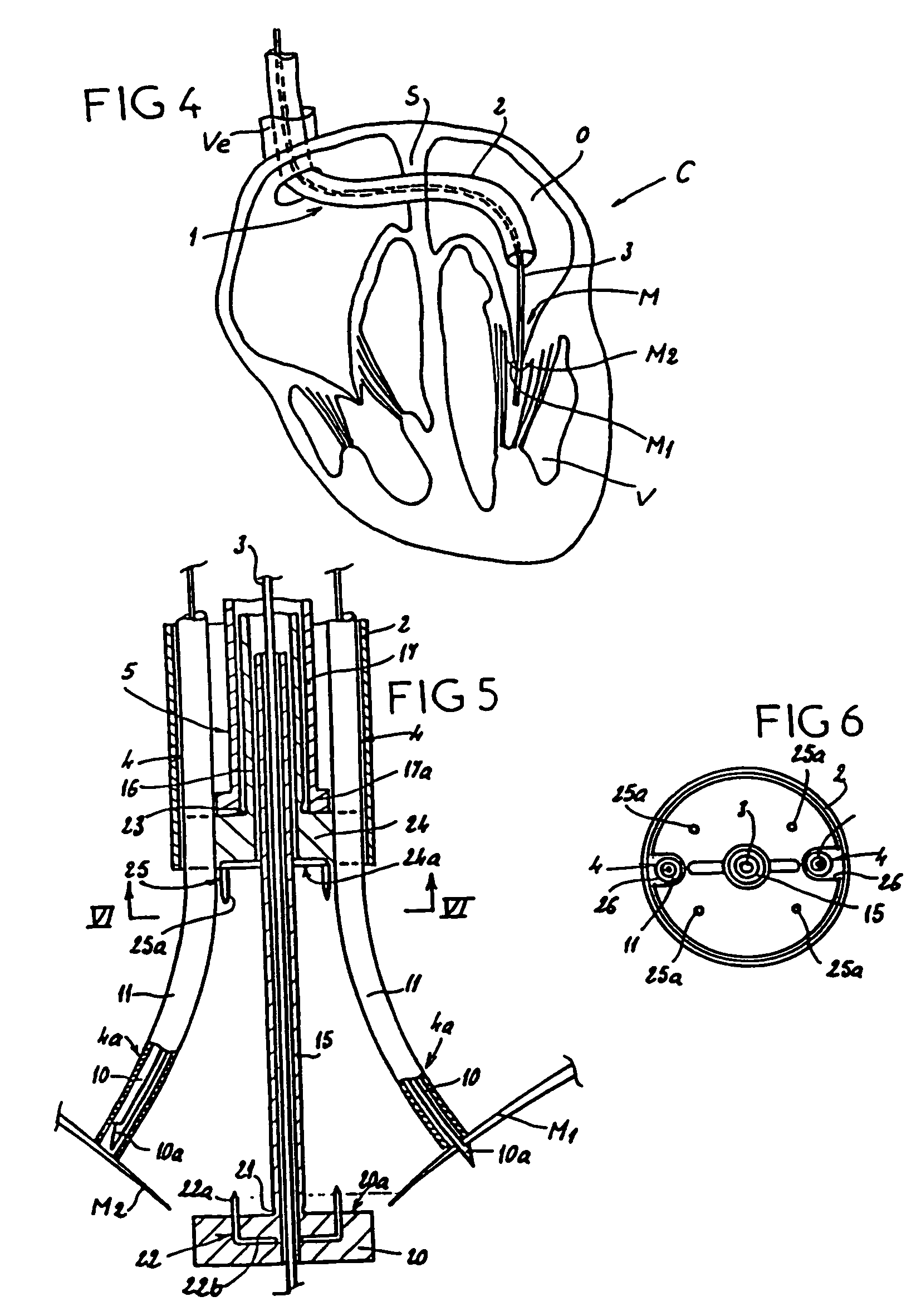 Surgical device for connecting soft tissue