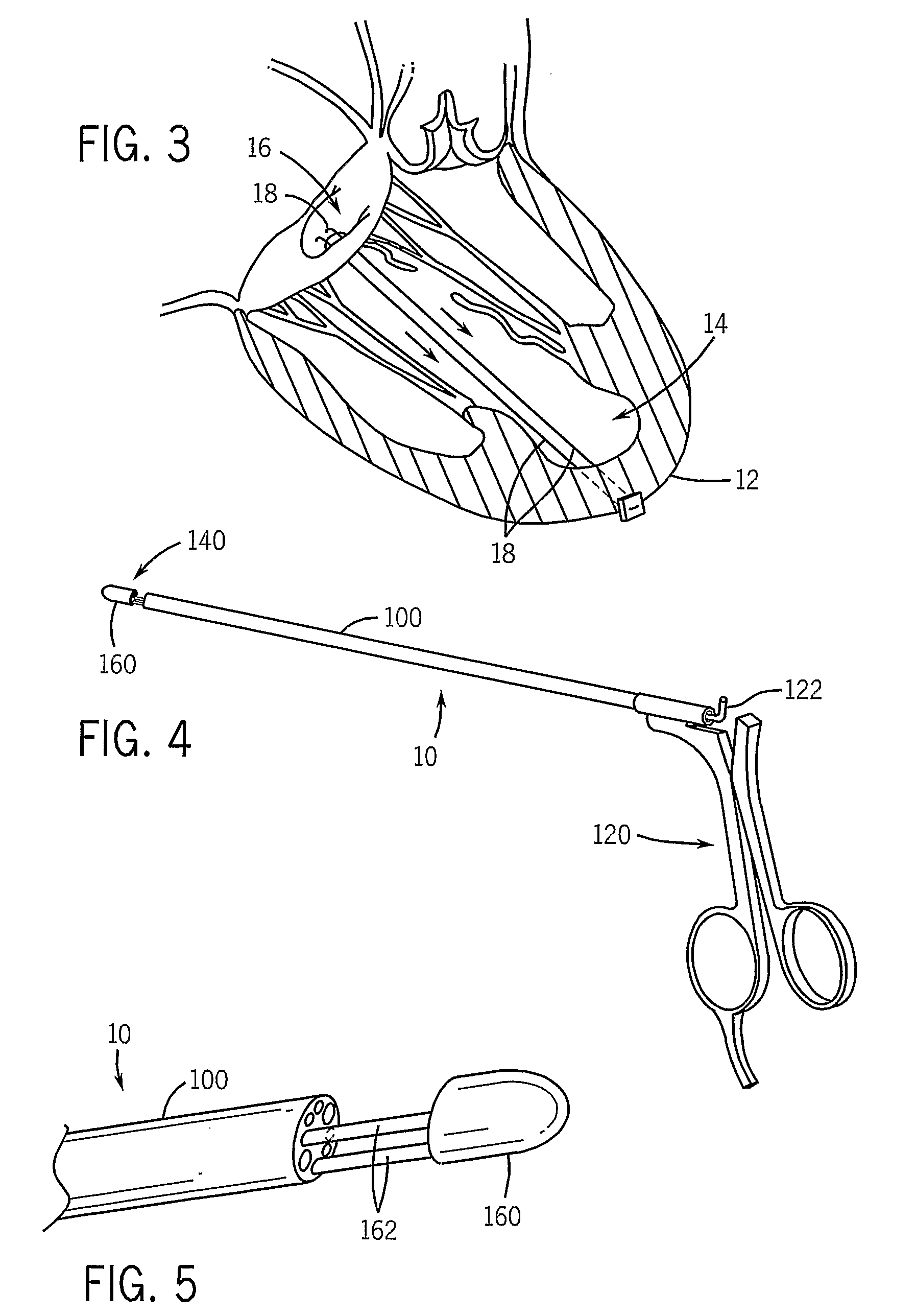 Thorascopic Heart Valve Repair Method and Apparatus