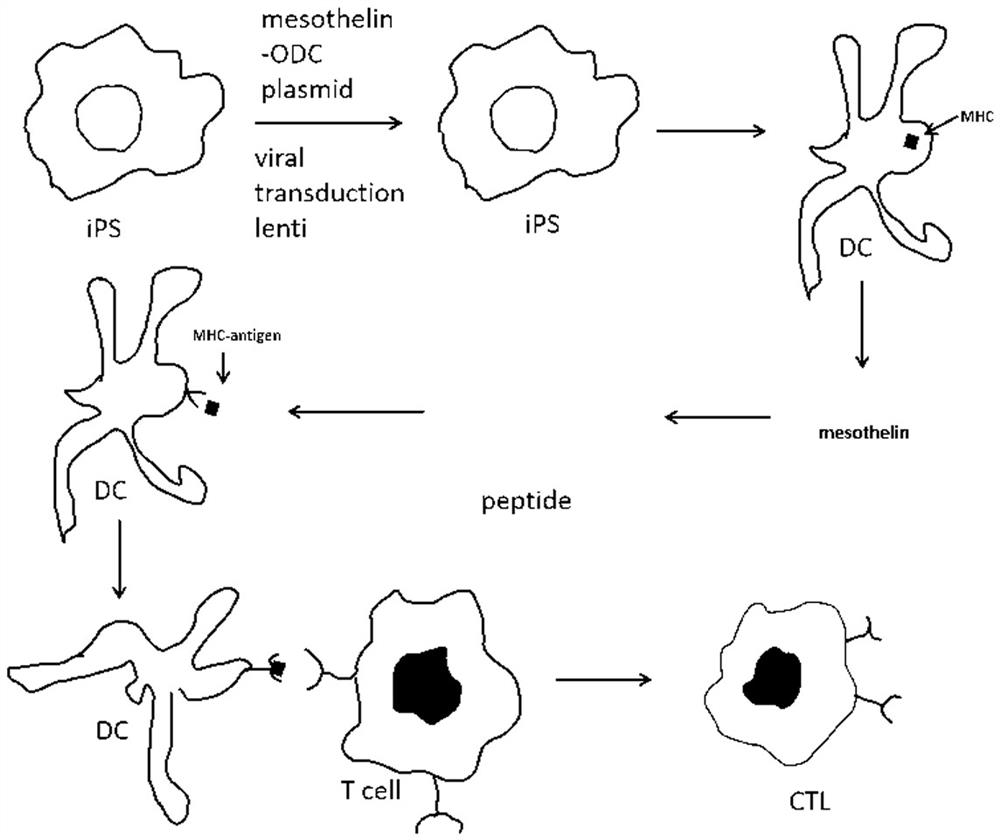 Mesothelin-ODC422-461 fusion protein expressed by DCs (dendritic cells) and application of mesothelin-ODC422-461 fusion protein