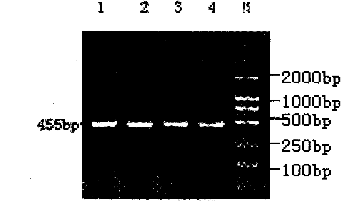 Identification and application of pig MHC II TA gene as immunity related molecular labels