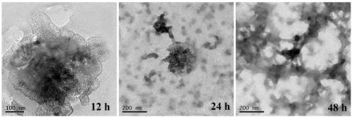 Photoresponsive degradable hollow mesoporous organic silicon nano composite particles as well as preparation method and application thereof