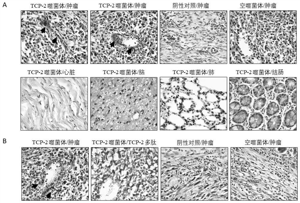 Tumor blood vessel and m1 type macrophage targeting peptide and use thereof