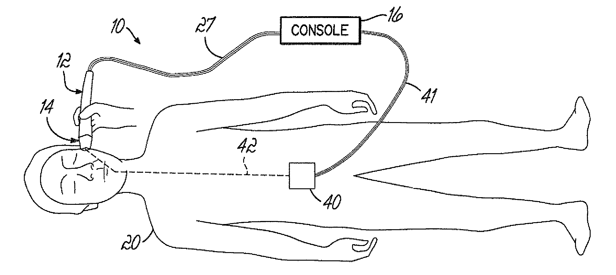 Methods and apparatus for predictively controlling the temperature of a coolant delivered to a treatment device