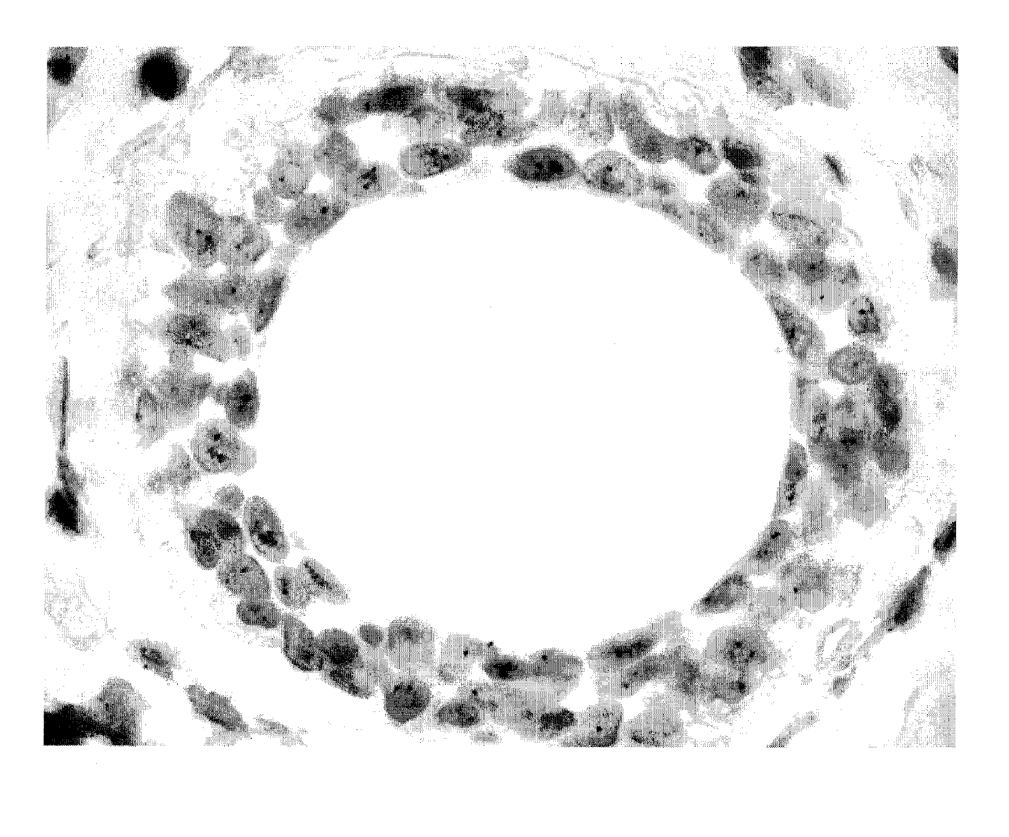 Site-specific enzymatic deposition of metal in situ