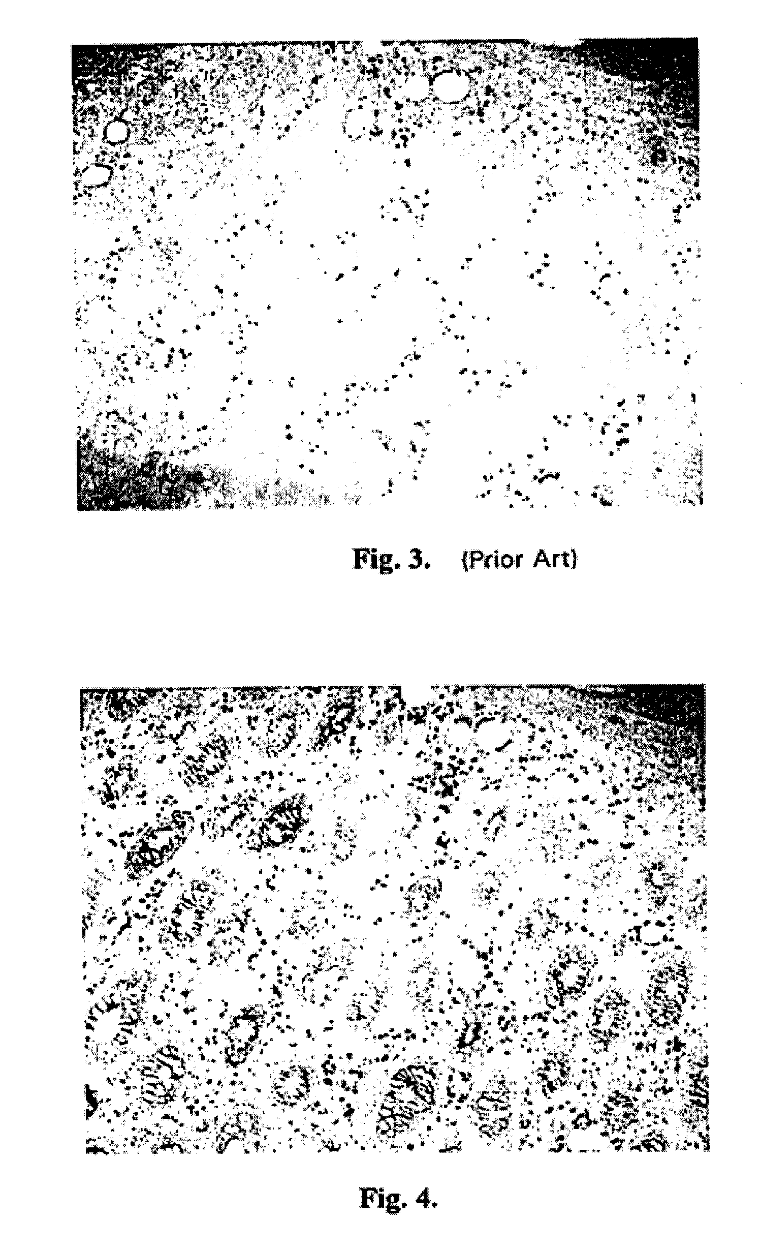 Site-specific enzymatic deposition of metal in situ