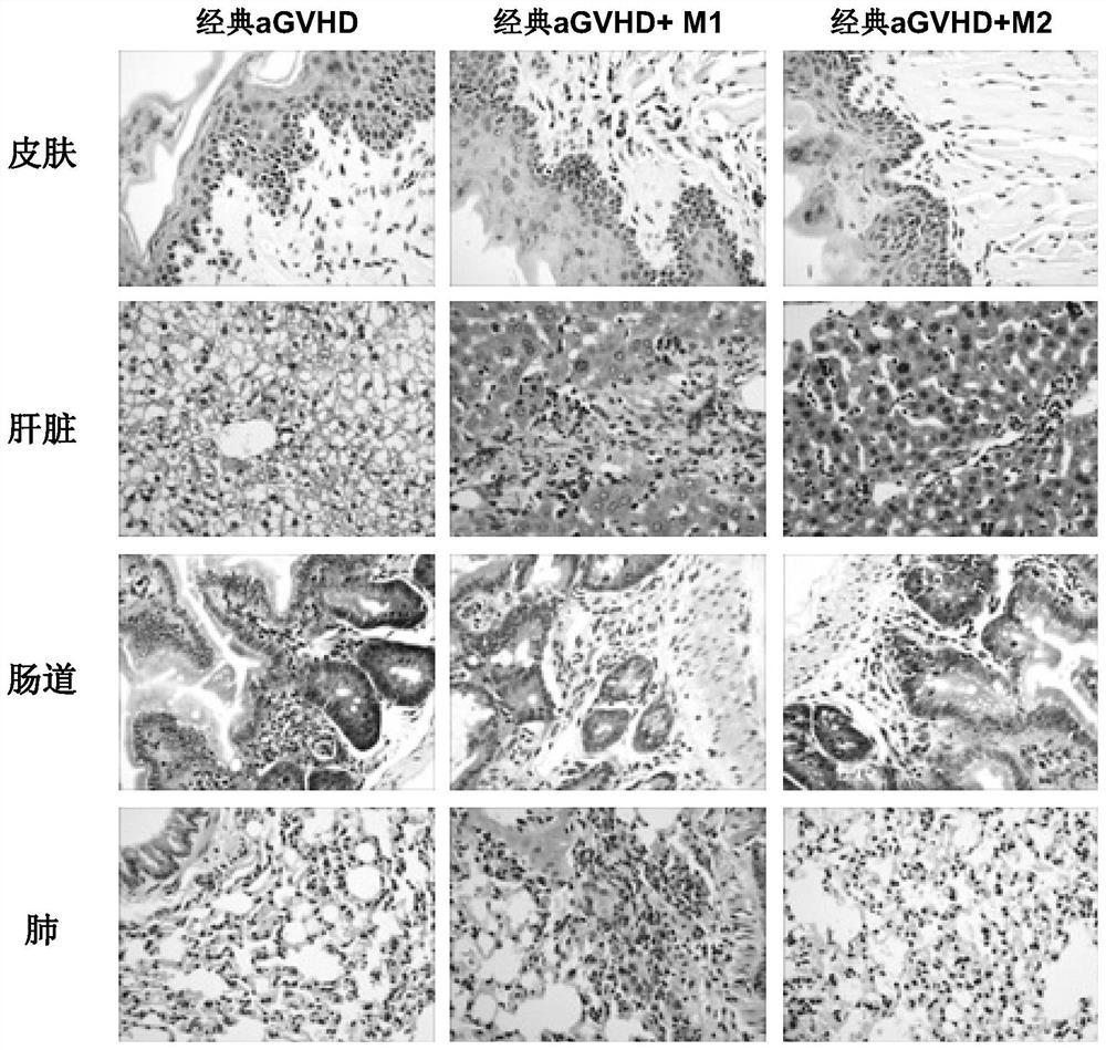 Application of macrophage subsets and their regulators in acute graft-versus-host disease