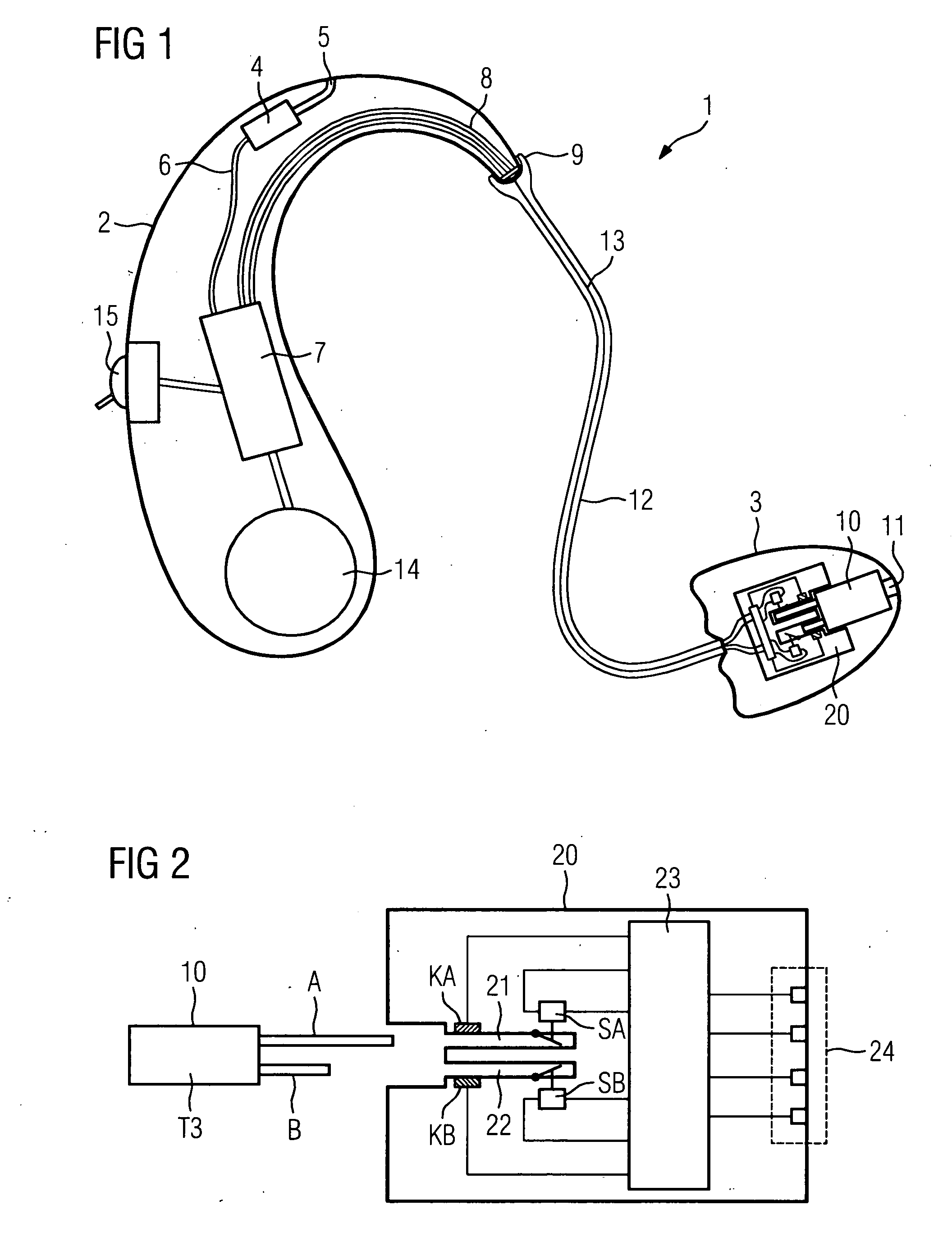 Automatic identification of receiver type in hearing aid devices