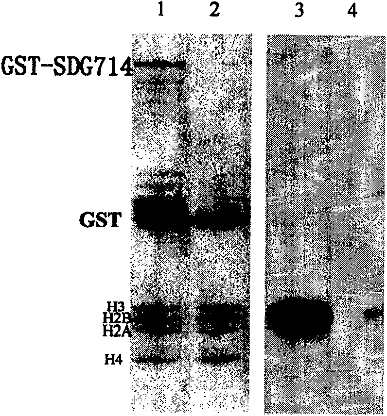 Histone methylated transferase and its encoding gene and application