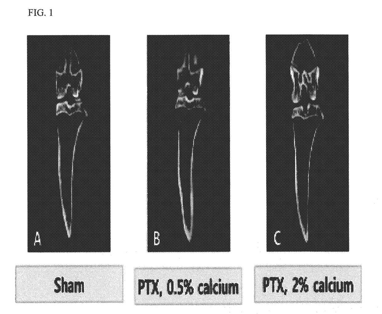 Animal model having hypoparathyroidism and method for producing the same