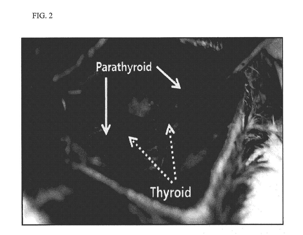 Animal model having hypoparathyroidism and method for producing the same