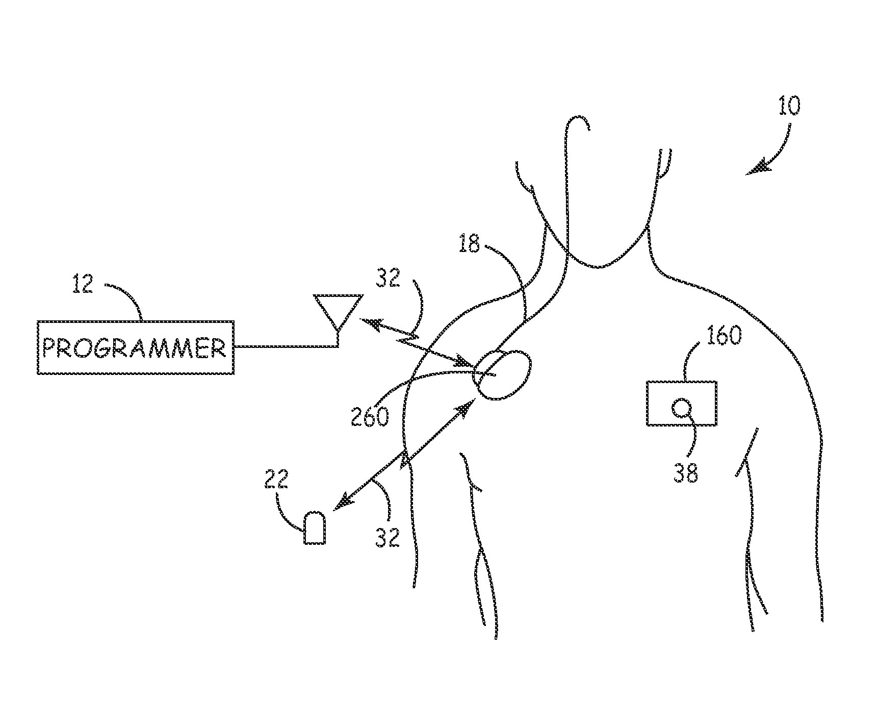 System and method for monitoring or treating nervous system disorders