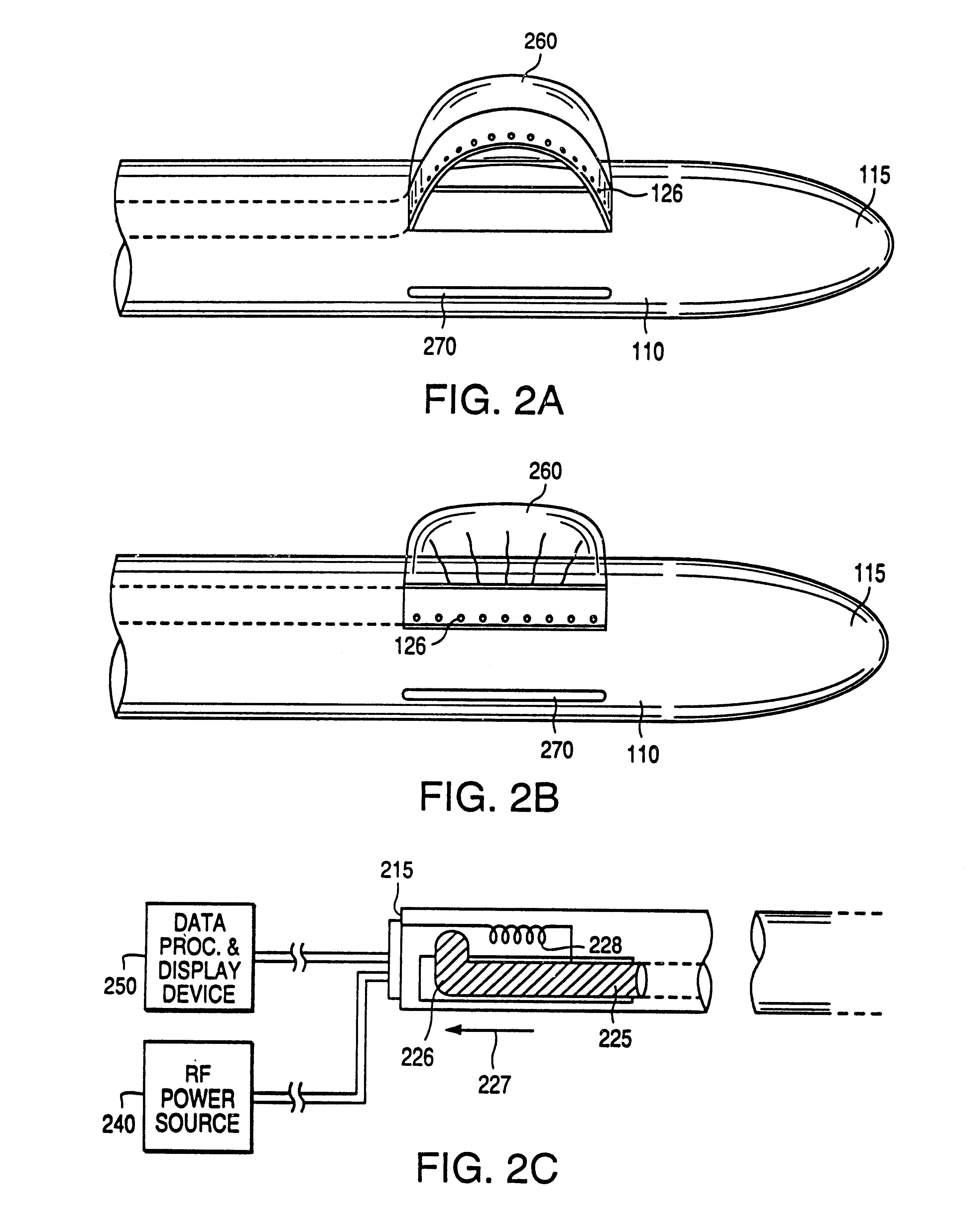 Excisional biopsy device and methods