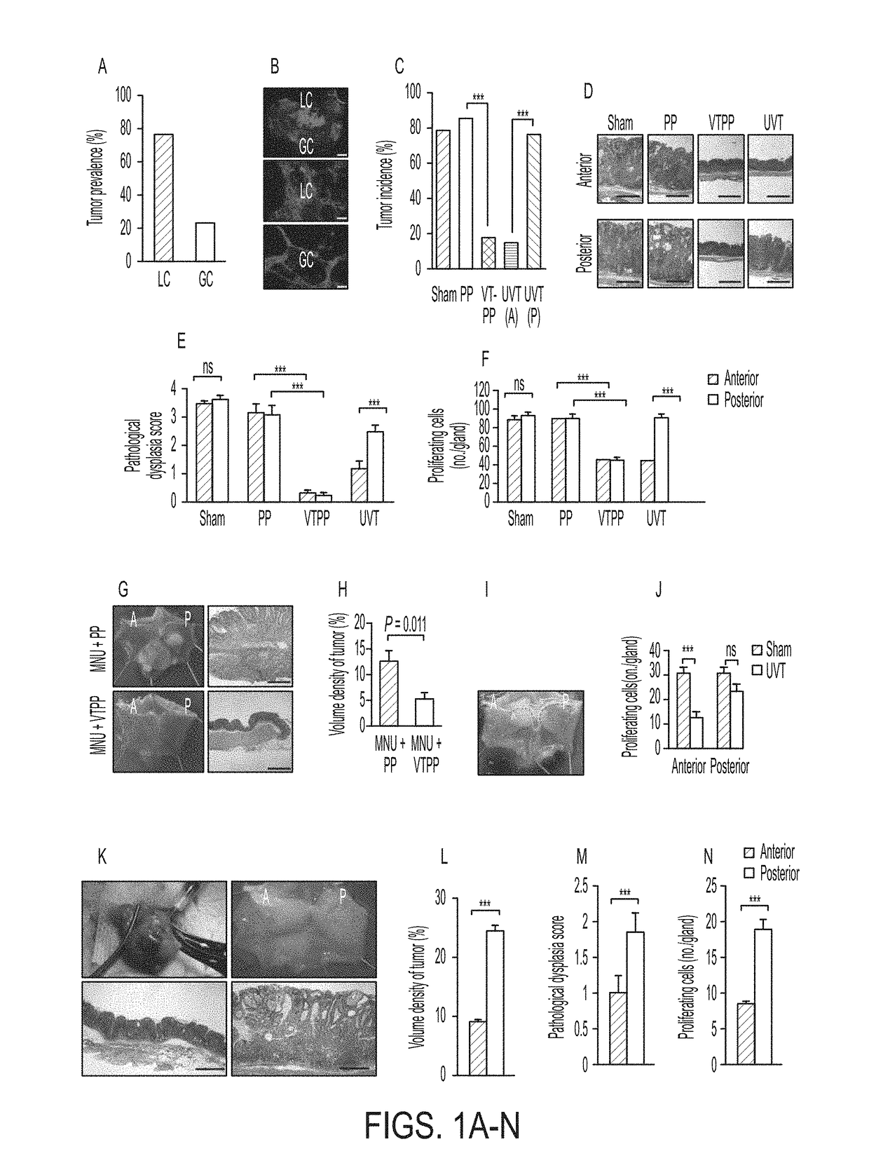 Cholinergic antagonism as an adjunct to cancer therapy