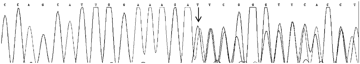 Kit for detecting mutation of pathogenic gene GJB2 of sensorineural deafness