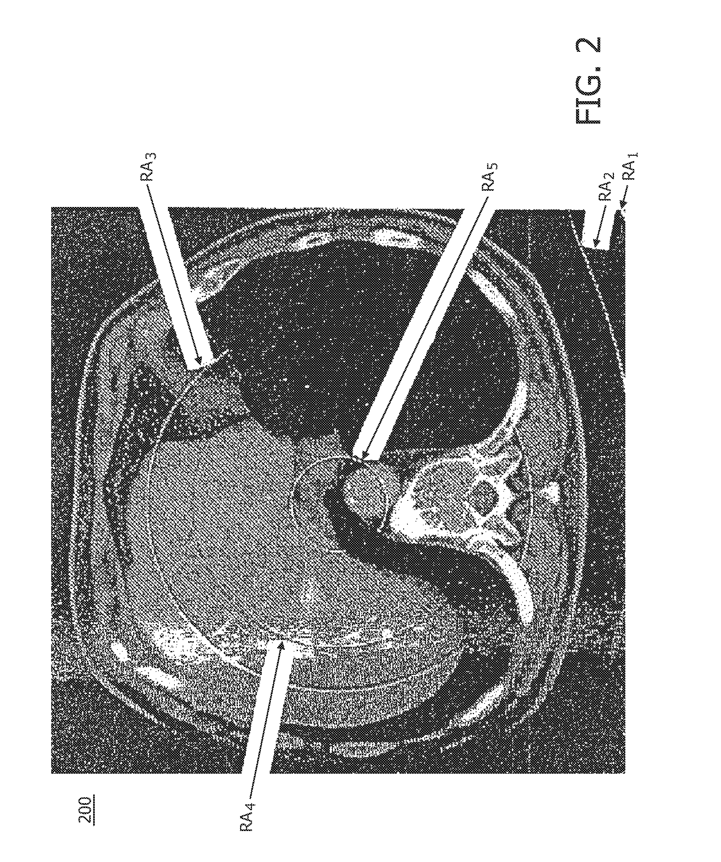 Calibration method for ring artifact correction in non-ideal isocentric 3D rotational X-ray scanner systems using a calibration phantom based rotation center finding algorithm