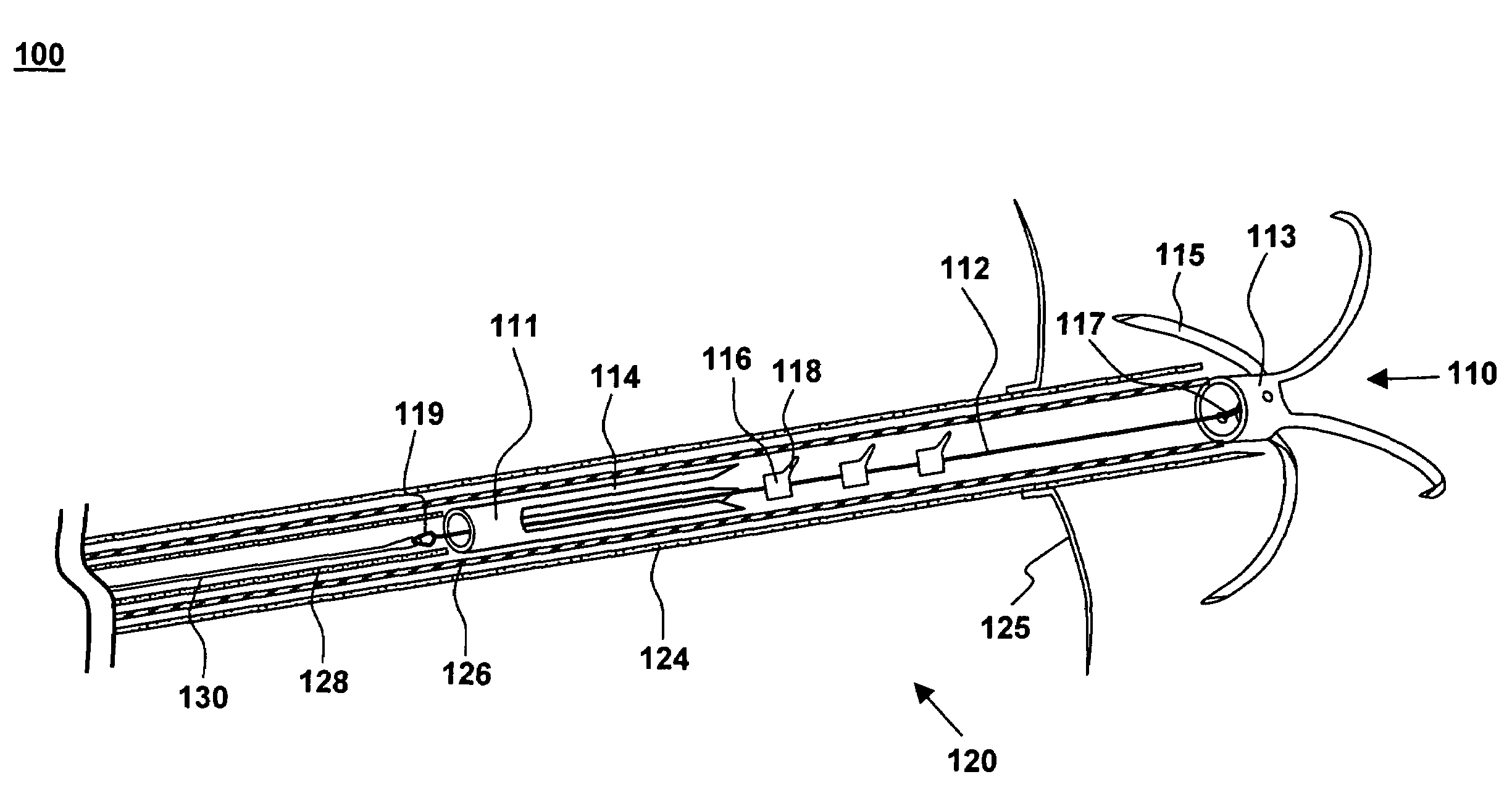 Tensioning device, system, and method for treating mitral valve regurgitation