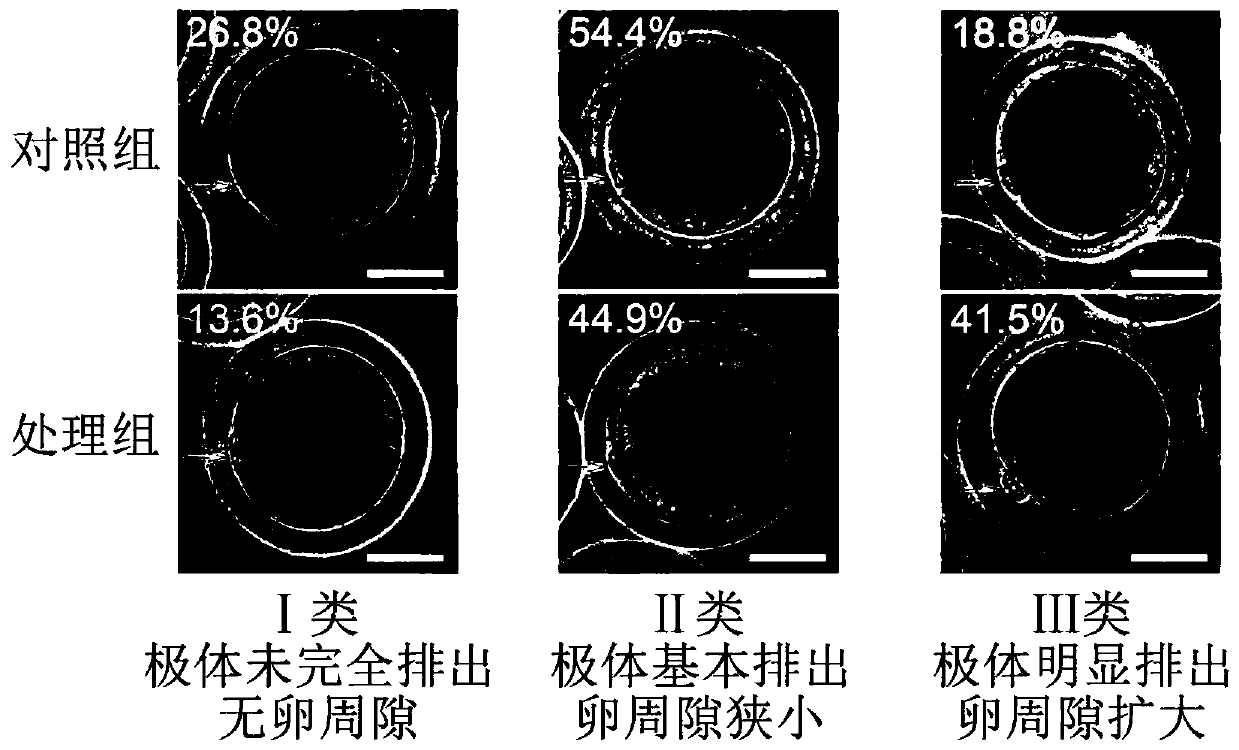 Culture solution for promoting in-vitro maturation of porcine oocytes