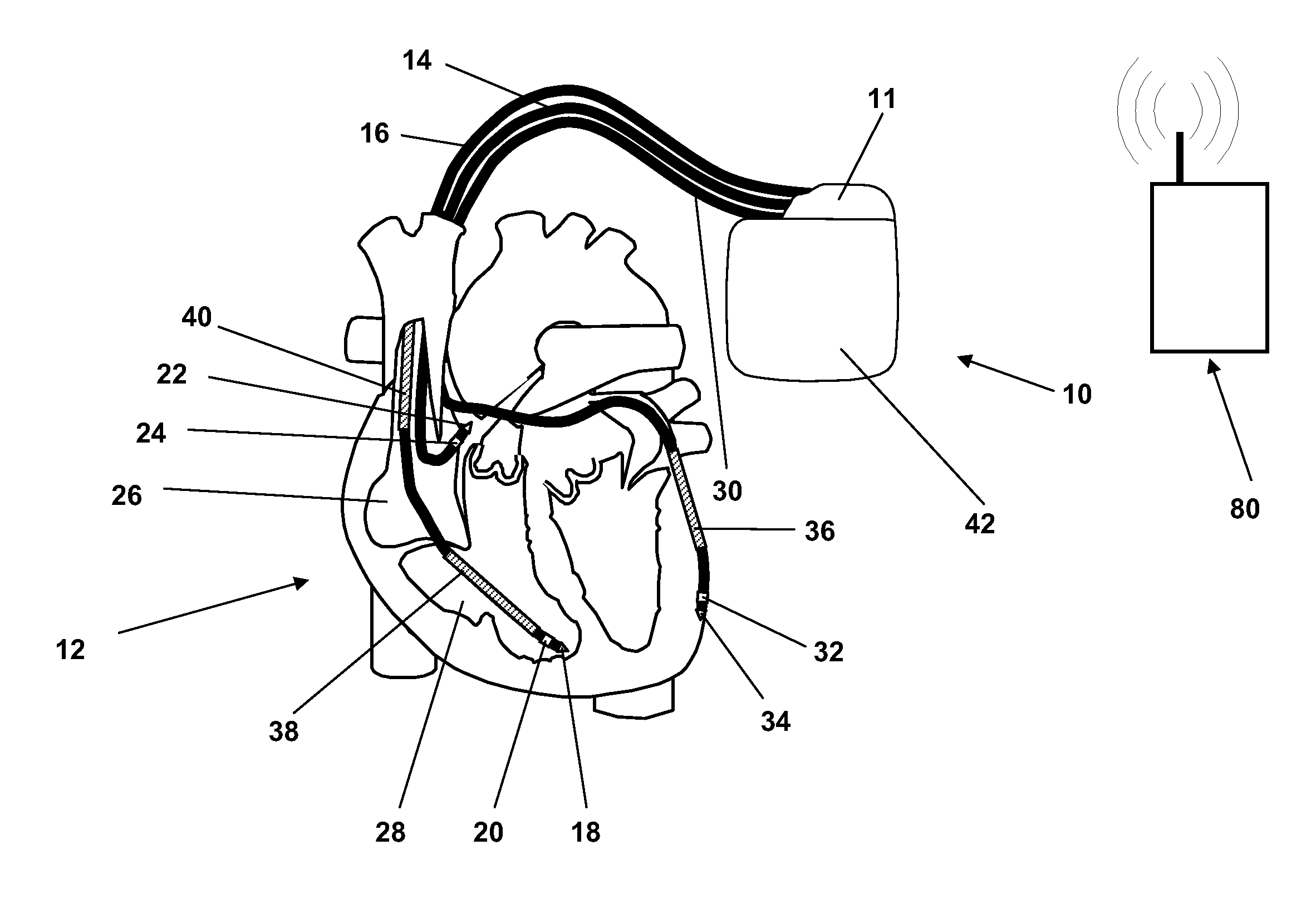 Switch polarity pacing to improve cardiac resynchronization therapy