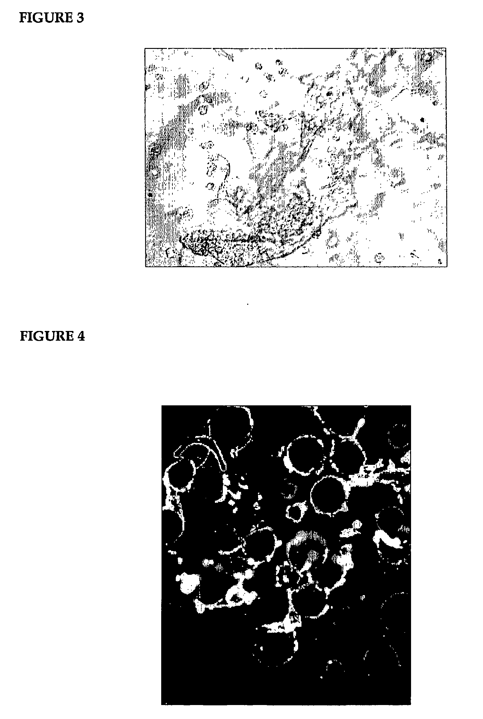 Preparation and Use of Basement Membrane Particles