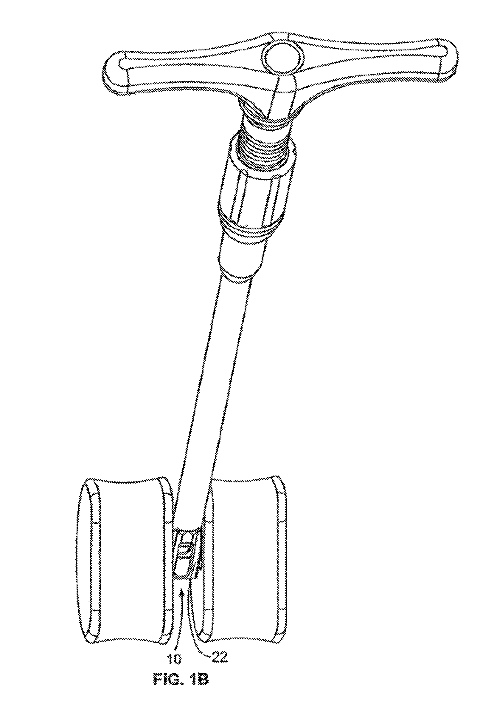 Methods and systems for interbody implant and bone graft delivery