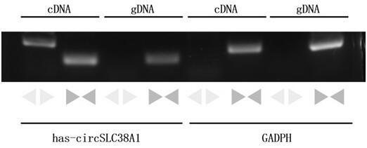 Application of circ-SLC38A1 as target point in medicine for inhibiting bladder cancer cells