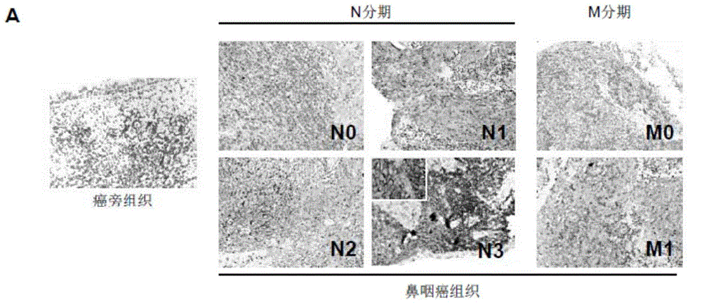 Target for screening and restraining transfer of nasopharyngeal carcinoma by using Flotillin-2 as medicine and application of target