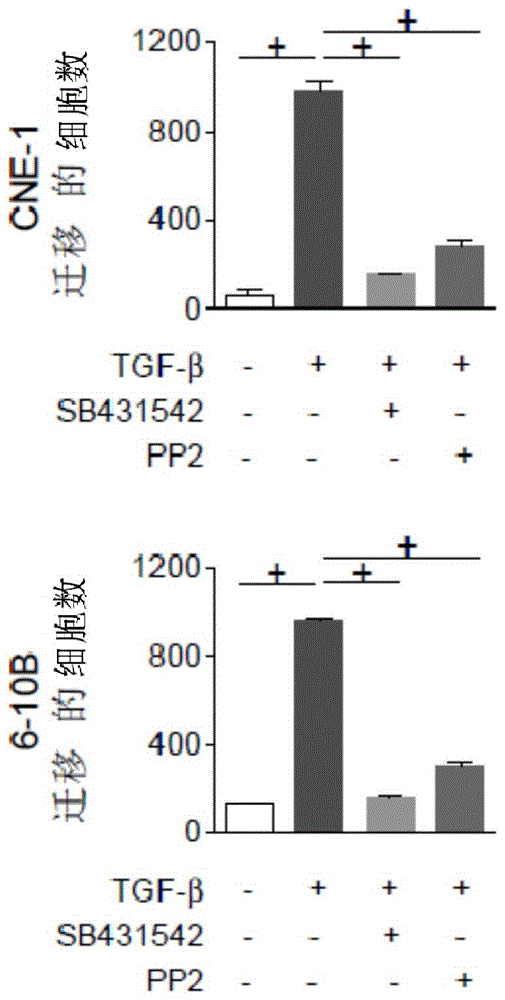 Target for screening and restraining transfer of nasopharyngeal carcinoma by using Flotillin-2 as medicine and application of target