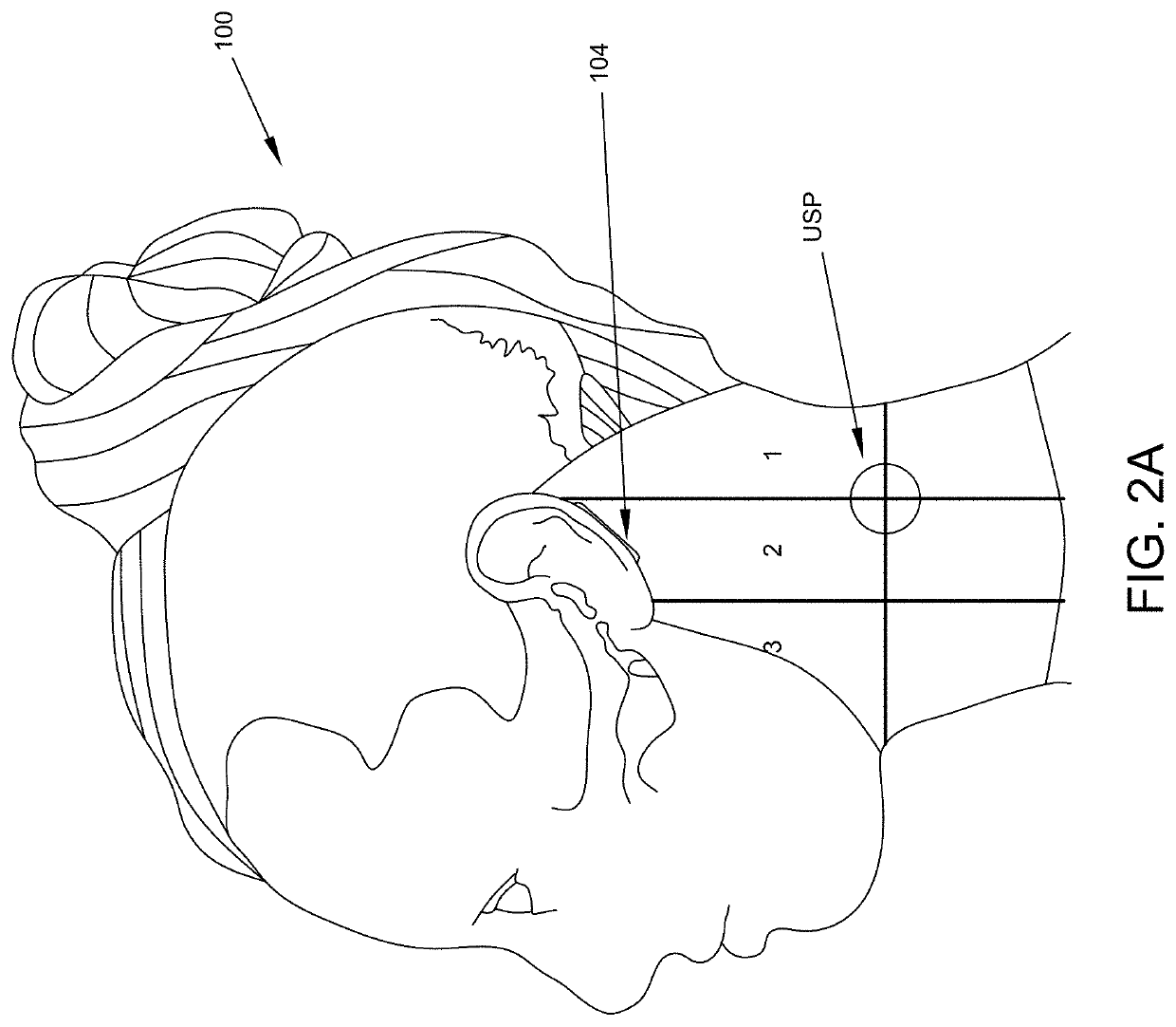 Enhanced physiological monitoring devices and computer-implemented systems and methods of remote physiological monitoring of subjects