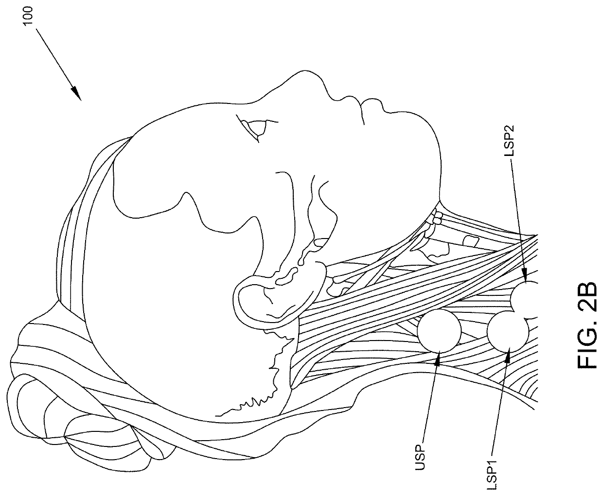 Enhanced physiological monitoring devices and computer-implemented systems and methods of remote physiological monitoring of subjects